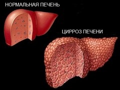 Лямблия печени лечение