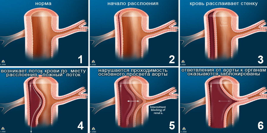 Кровать для лечения позвоночника нуга бест